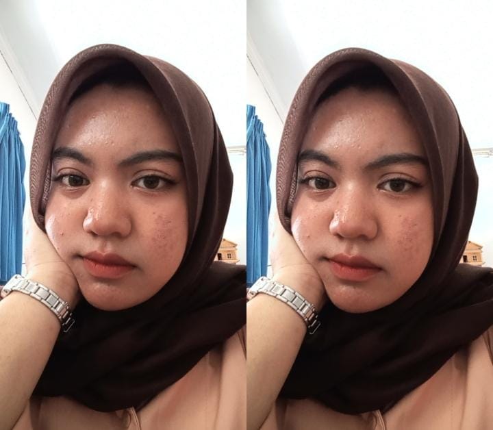 Foto Silpa 6